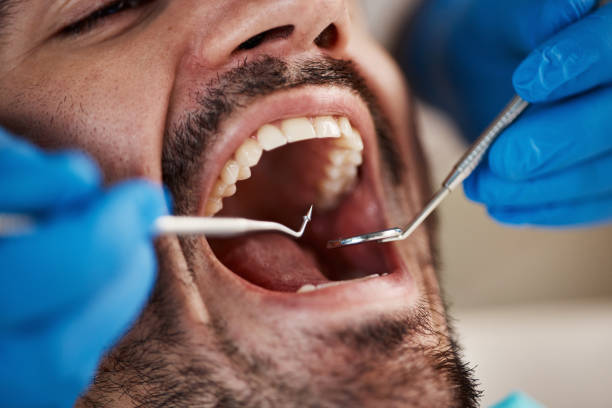 Best Weekend Emergency Dentist in Garrett, WA